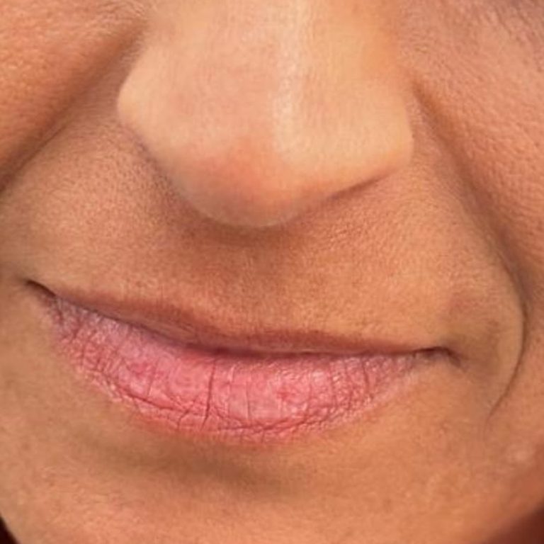 Nahaufnahme eines mündlichen Bereichs mit sichtbaren Lippen und Hautstrukturen.